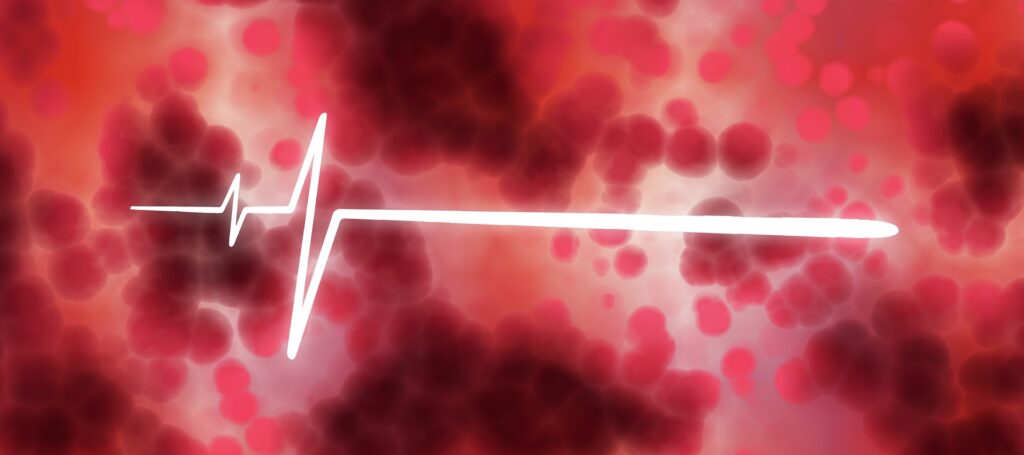 Falência circulatória